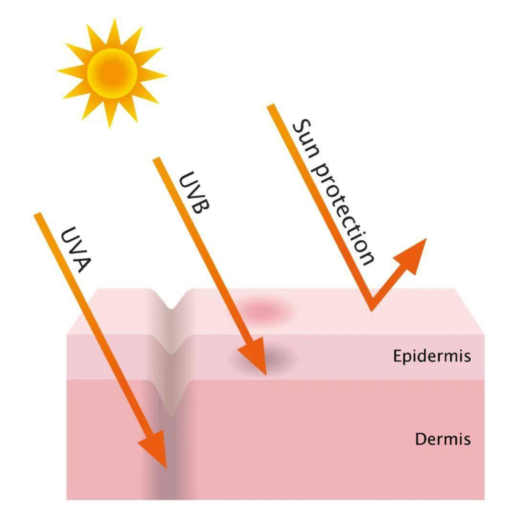 Light damage to skin